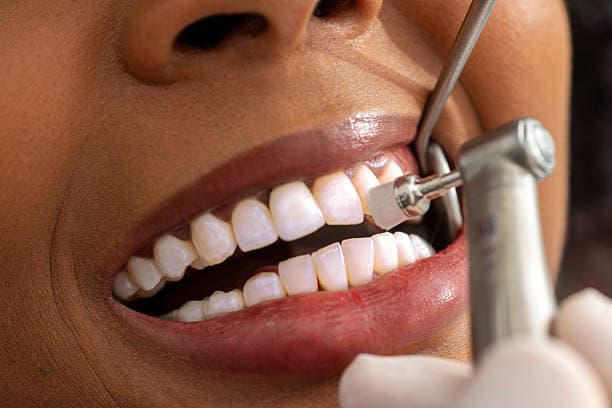 Prevenção e Limpeza Odontológica