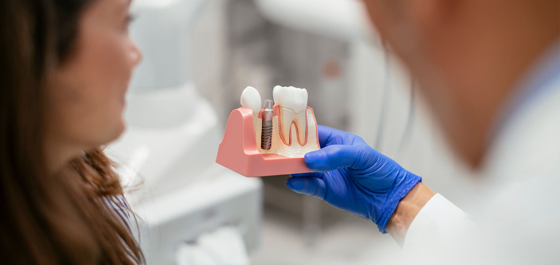 Mitos e verdades: Afinal, colocar implante dentário dói?